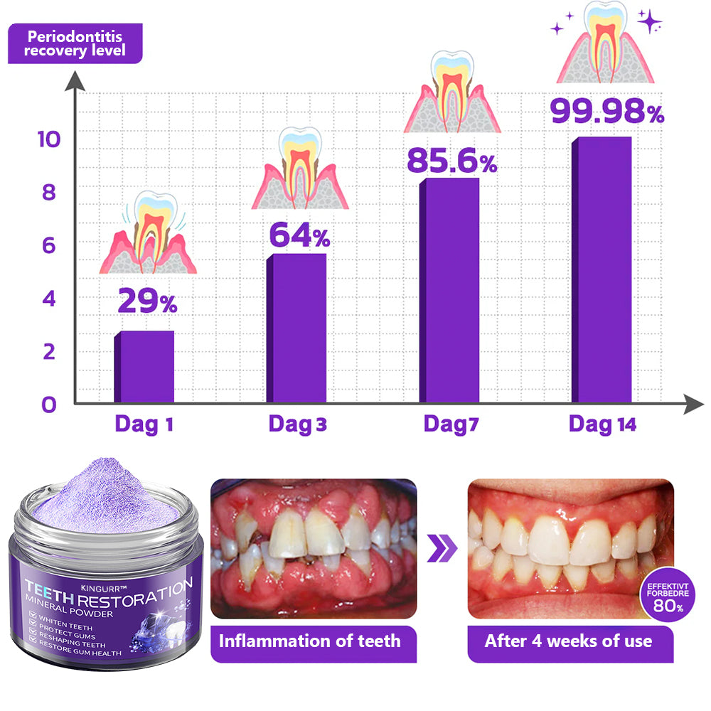 Only 5 boxes left! We are offering you an additional 30% OFF! Dentist tested to completely cure all types of dental problems in 3-6 weeks! If you miss it, you won't get it until next year!