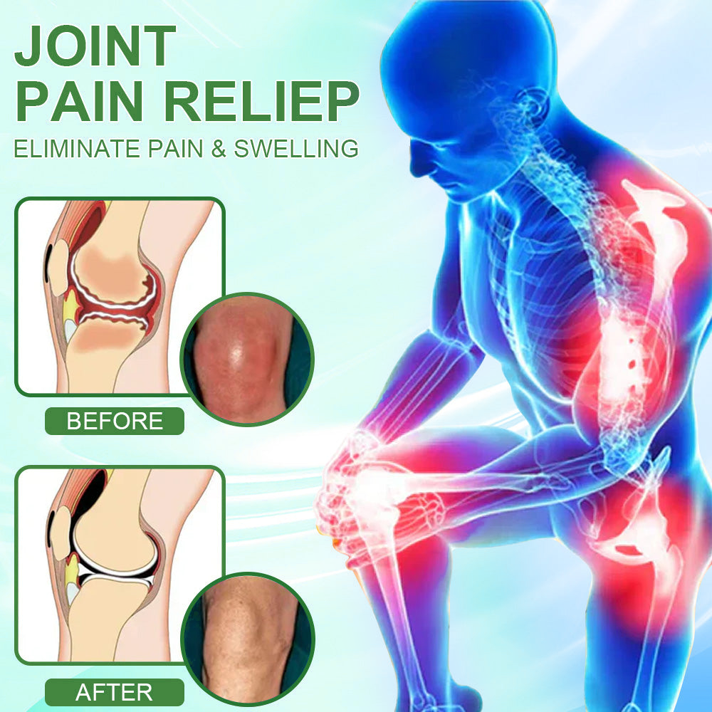 Picdo® Chillflex Fast-Acting Joint Pain Cream🌱For the treatment of |Arthritis|Joint deformities|Rheumatism|Sports injuries|Muscle injuries