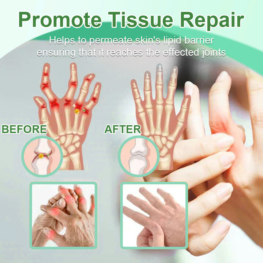 Picdo® Chillflex Fast-Acting Joint Pain Cream🌱For the treatment of |Arthritis|Joint deformities|Rheumatism|Sports injuries|Muscle injuries