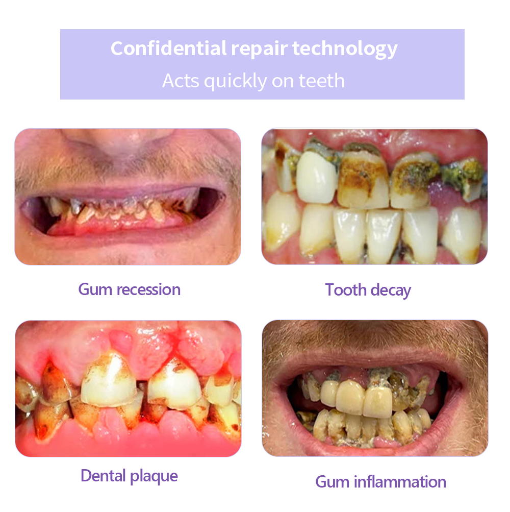 Only 5 boxes left! We are offering you an additional 30% OFF! Dentist tested to completely cure all types of dental problems in 3-6 weeks! If you miss it, you won't get it until next year!