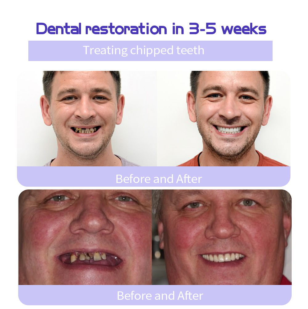 Only 5 boxes left! We are offering you an additional 30% OFF! Dentist tested to completely cure all types of dental problems in 3-6 weeks! If you miss it, you won't get it until next year!