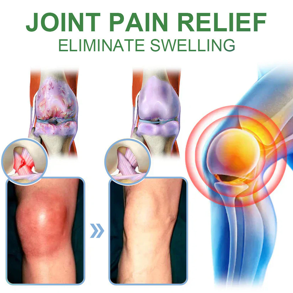 Picdo® Chillflex Fast-Acting Joint Pain Cream🌱For the treatment of |Arthritis|Joint deformities|Rheumatism|Sports injuries|Muscle injuries