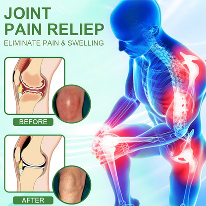 Picdo® Chillflex Fast-Acting Joint Pain Cream🌱For the treatment of |Arthritis|Joint deformities|Rheumatism|Sports injuries|Muscle injuries